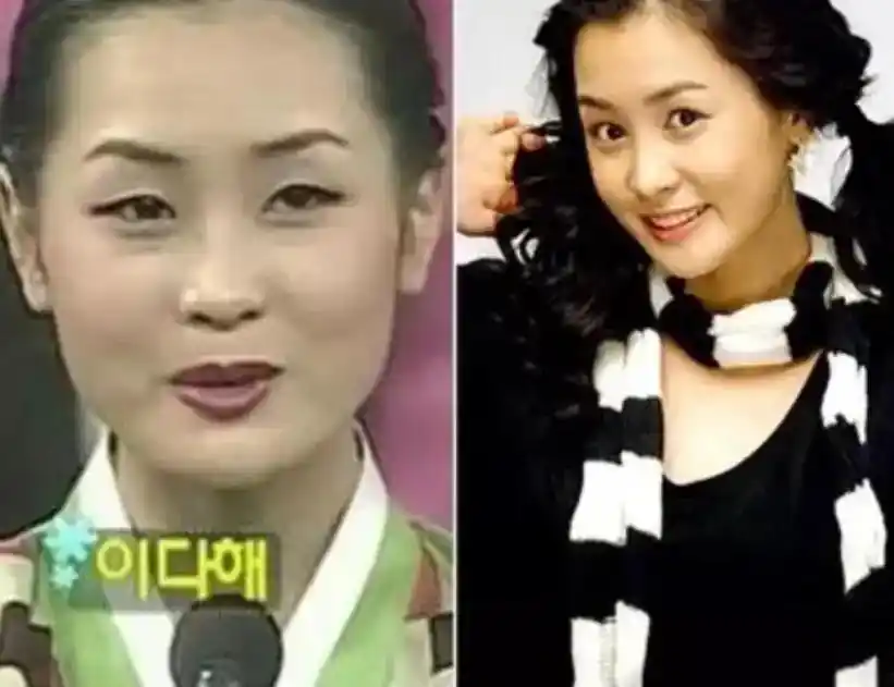 韩剧女主整容前后对比_韩剧整容女明星_韩国整容文化